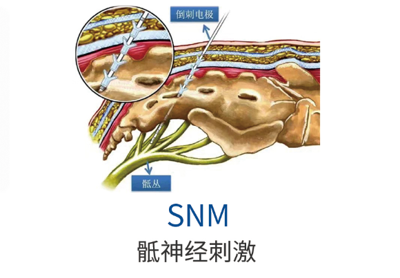 413a22a9a4cf745e46009a0bb2c42ef1.png