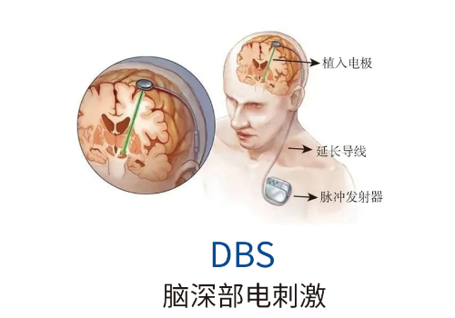727bb380eb9bf4fa9eb005c949e7b2bb.png