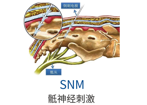 3c948dda67fa617a1616104cb54ac141.png